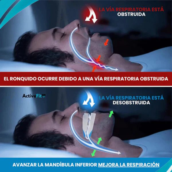 PROTECTOR BUCAL ANTIRONQUIDOS BIOVITA