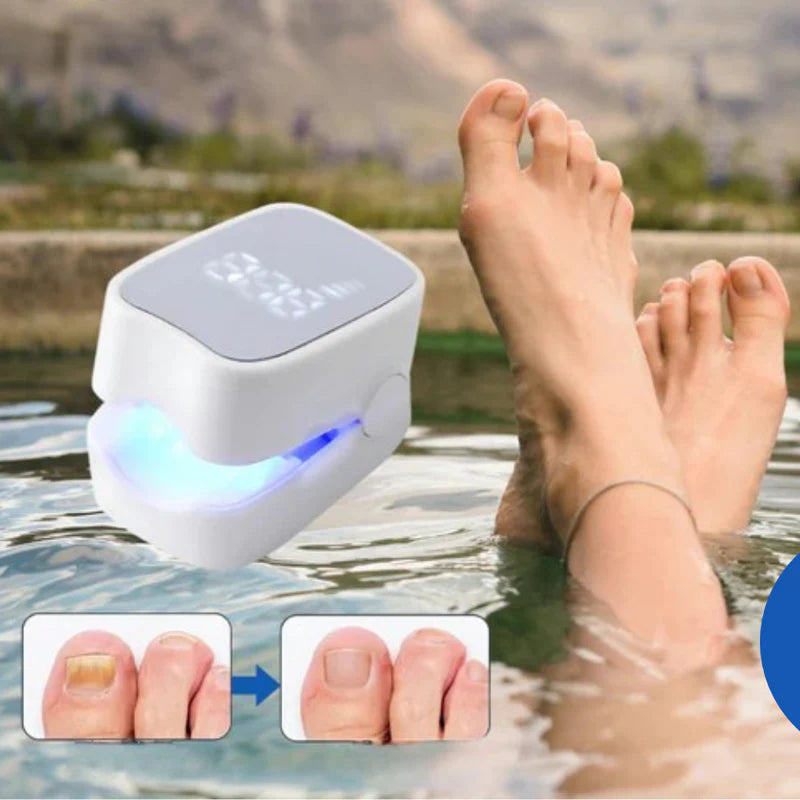DISPOSITIVO LÁSER ANTIHONGOS PARA UÑAS–NAILCURE PRO™ | TRATAMIENTO EN CASA SIN DOLOR.
