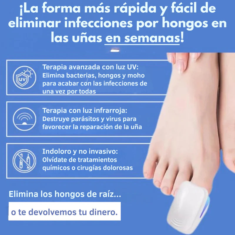 DISPOSITIVO LÁSER ANTIHONGOS PARA UÑAS–NAILCURE PRO™ | TRATAMIENTO EN CASA SIN DOLOR.