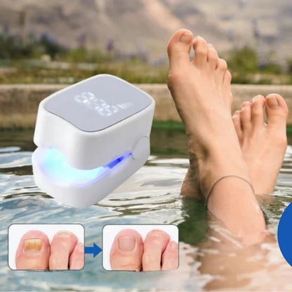 DISPOSITIVO LÁSER ANTIHONGOS PARA UÑAS–NAILCURE PRO™ | TRATAMIENTO EN CASA SIN DOLOR.