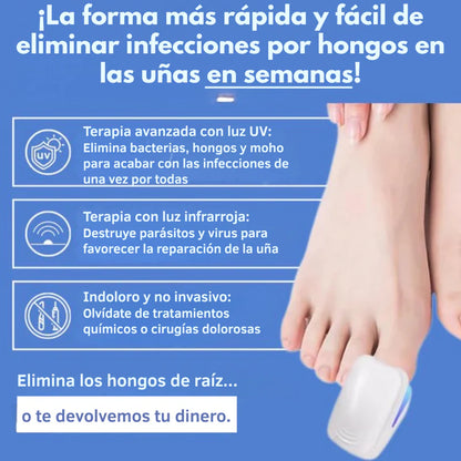 DISPOSITIVO LÁSER ANTIHONGOS PARA UÑAS–NAILCURE PRO™ | TRATAMIENTO EN CASA SIN DOLOR.